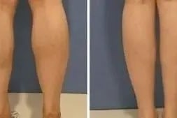 减肥分享_余平：瘦小腿最有效最快速的方法，小腿肚子胖怎么办_减肥不走弯路